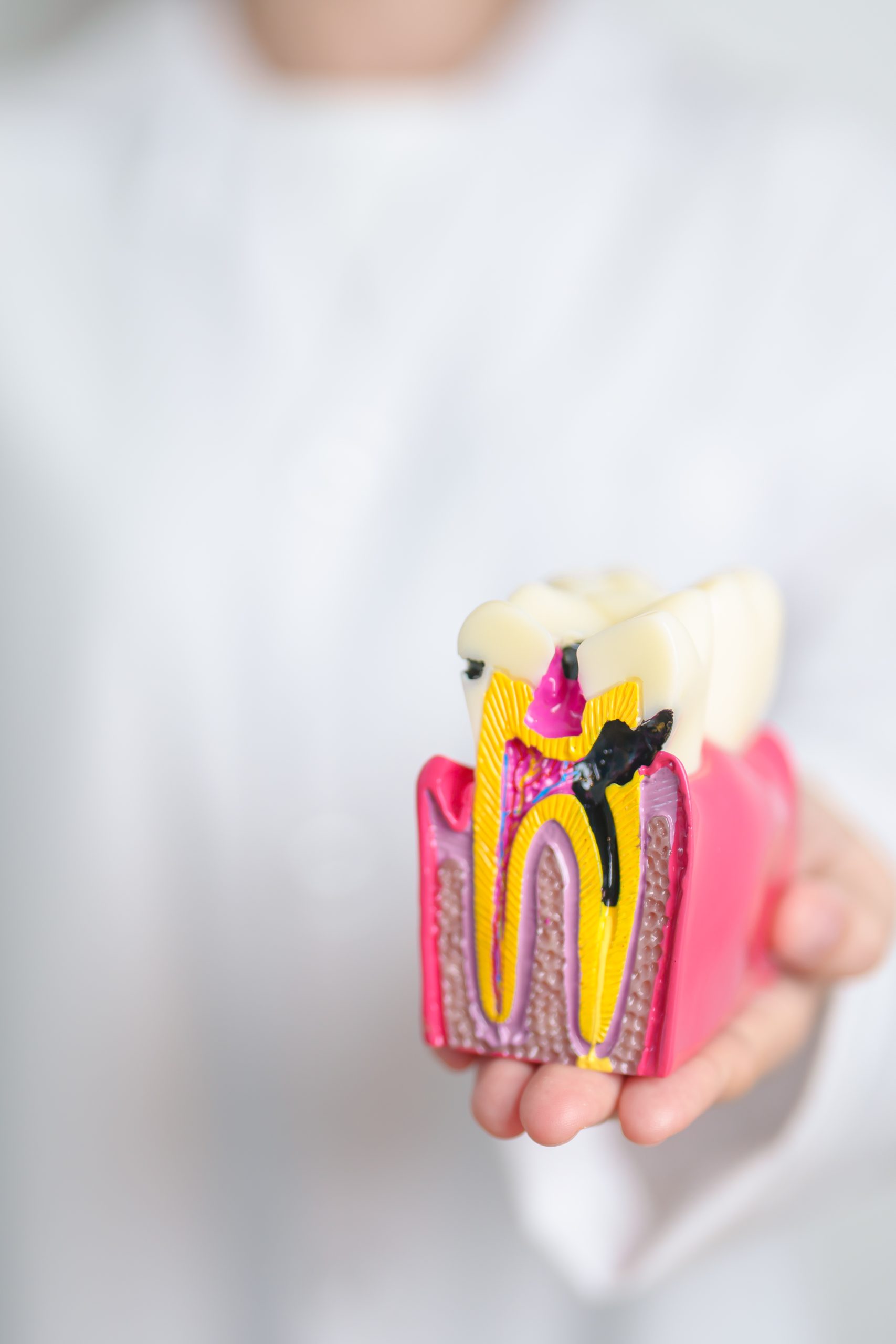 Dentist holding a tooth anatomy model illustrating oral structures and decay